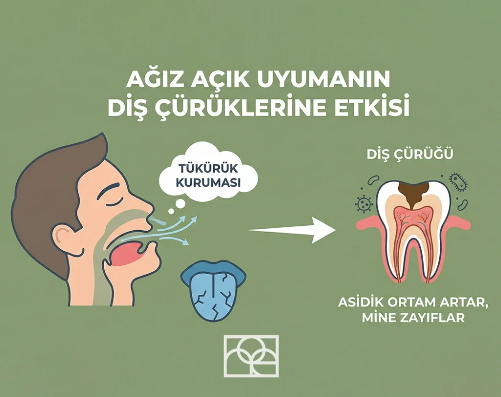 Ağız Açık Uyuma diş çürüklerine etkisi , Ağız Açık Uyuma diş çürüklerine etkisi Bilkent , Ağız Açık Uyuma diş çürüklerine etkisi Mustafa Kemal Mahallesi ,Ağız Açık Uyuma diş çürüklerine etkisi Çukurambar , Ağız Açık Uyuma diş çürüklerine etkisi Çayyolu Noedent Maidan Diş Kliniği