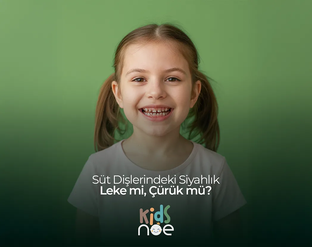 süt dişlerindeki siyahlık leke mi çürük mü ? Maidan Diş Kliniği Noedent