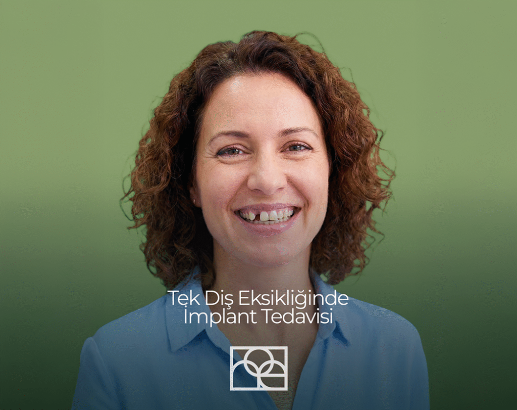 Söğütözü Tek Diş İmplant , Tek Diş İmplant Bilkent , , Tek Diş İmplant Mustafa Kemal Mahallesi ,Tek Diş İmplant Çukurambar , Tek Diş İmplant Çayyolu Noedent Maidan Diş Kliniği
