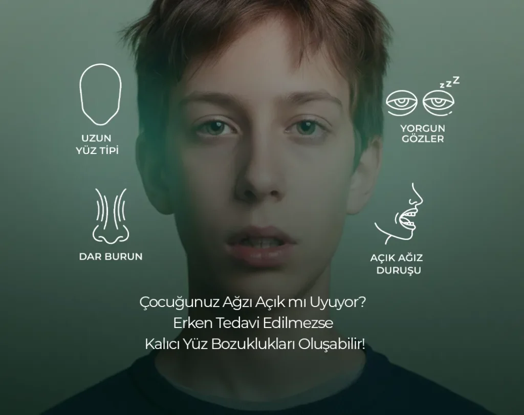 Ağız Açık Uyuma diş çürüklerine etkisi , Ağız Açık Uyuma diş çürüklerine etkisi Bilkent , Ağız Açık Uyuma diş çürüklerine etkisi Mustafa Kemal Mahallesi ,Ağız Açık Uyuma diş çürüklerine etkisi Çukurambar , Ağız Açık Uyuma diş çürüklerine etkisi Çayyolu Noedent Maidan Diş Kliniği