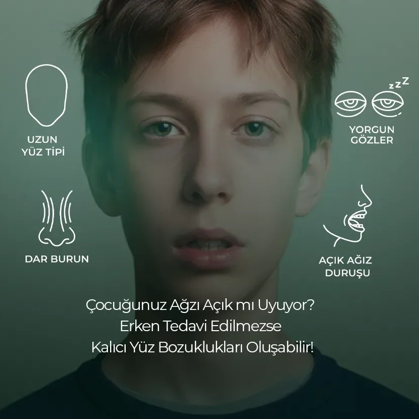 Ağız Açık Uyuma diş çürüklerine etkisi , Ağız Açık Uyuma diş çürüklerine etkisi Bilkent , Ağız Açık Uyuma diş çürüklerine etkisi Mustafa Kemal Mahallesi ,Ağız Açık Uyuma diş çürüklerine etkisi Çukurambar , Ağız Açık Uyuma diş çürüklerine etkisi Çayyolu Noedent Maidan Diş Kliniği