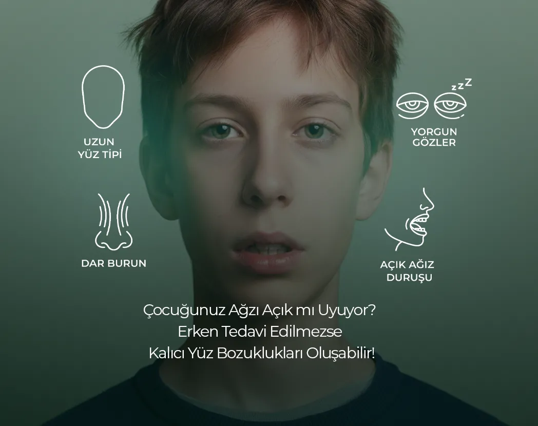 Ağız Açık Uyuma diş çürüklerine etkisi , Ağız Açık Uyuma diş çürüklerine etkisi Bilkent , Ağız Açık Uyuma diş çürüklerine etkisi Mustafa Kemal Mahallesi ,Ağız Açık Uyuma diş çürüklerine etkisi Çukurambar , Ağız Açık Uyuma diş çürüklerine etkisi Çayyolu Noedent Maidan Diş Kliniği