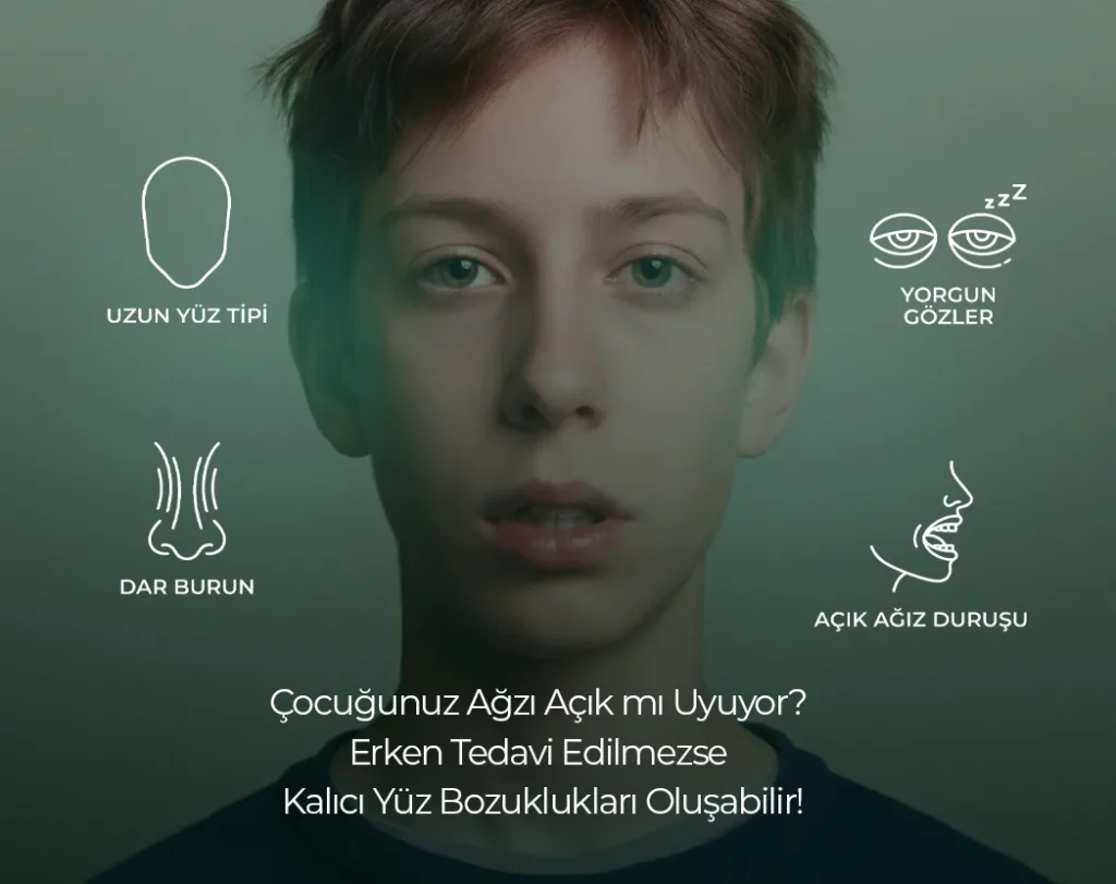 Ağız Açık Uyuma diş çürüklerine etkisi , Ağız Açık Uyuma diş çürüklerine etkisi Bilkent , Ağız Açık Uyuma diş çürüklerine etkisi Mustafa Kemal Mahallesi ,Ağız Açık Uyuma diş çürüklerine etkisi Çukurambar , Ağız Açık Uyuma diş çürüklerine etkisi Çayyolu Noedent Maidan Diş Kliniği