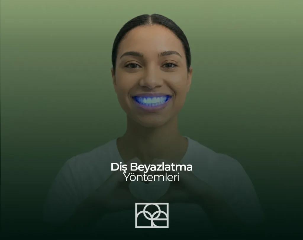 Bleaching Nedir? Diş Beyazlatma Yöntemleri , Bleaching Nedir? Diş Beyazlatma Yöntemleri Bilkent , Bleaching Nedir? Diş Beyazlatma Yöntemleri Mustafa Kemal Mahallesi ,Bleaching Nedir? Diş Beyazlatma Yöntemleri Çukurambar , Bleaching Nedir? Diş Beyazlatma Yöntemleri Çayyolu Noedent Maidan Diş Kliniği