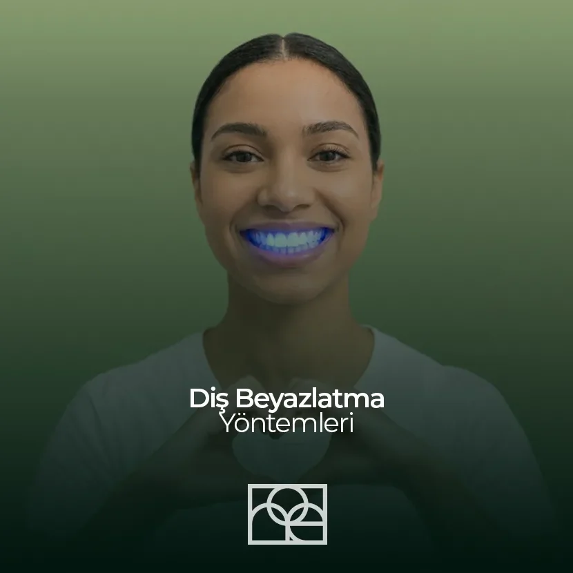 Bleaching Nedir? Diş Beyazlatma Yöntemleri , Bleaching Nedir? Diş Beyazlatma Yöntemleri Bilkent , Bleaching Nedir? Diş Beyazlatma Yöntemleri Mustafa Kemal Mahallesi ,Bleaching Nedir? Diş Beyazlatma Yöntemleri Çukurambar , Bleaching Nedir? Diş Beyazlatma Yöntemleri Çayyolu Noedent Maidan Diş Kliniği
