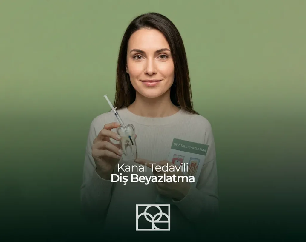 kanal tedavili dişi beyazlatma , devital beyazlatma , içten beyazlatma