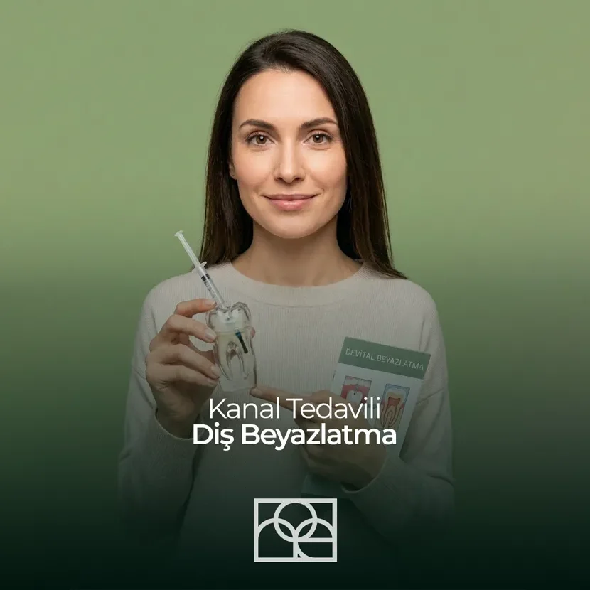 kanal tedavili dişi beyazlatma , devital beyazlatma , içten beyazlatma