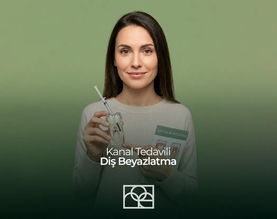 kanal tedavili dişi beyazlatma , devital beyazlatma , içten beyazlatma