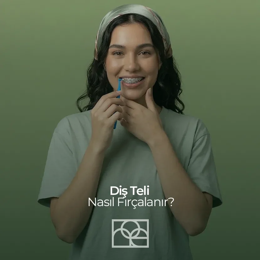 Ortodontik Ağız Bakımı , Diş Teli Nasıl Fırçalanır Bilkent ,Apikal Rezeksiyon Mustafa Kemal Mahallesi ,Gingivitis , diş eti hastalığı Çukurambar ,Apikal Rezeksiyon Çayyolu Noedent Maidan Diş Kliniği