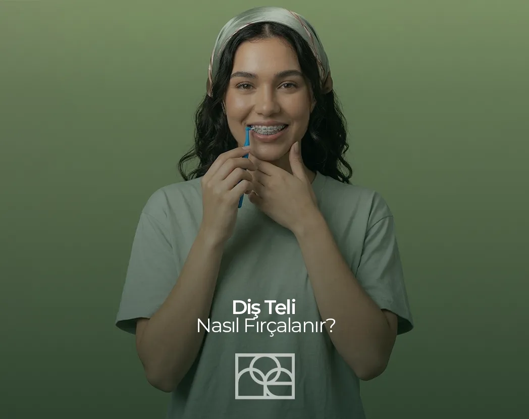 Ortodontik Ağız Bakımı , Diş Teli Nasıl Fırçalanır Bilkent ,Apikal Rezeksiyon Mustafa Kemal Mahallesi ,Gingivitis , diş eti hastalığı Çukurambar ,Apikal Rezeksiyon Çayyolu Noedent Maidan Diş Kliniği