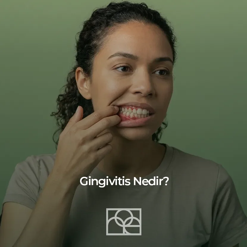 Gingivitis Nedir , diş eti hastalığı , Gingivitis , diş eti hastalığı Bilkent , Gingivitis , diş eti hastalığı Mustafa Kemal Mahallesi ,Gingivitis , diş eti hastalığı Çukurambar , Gingivitis , diş eti hastalığı Çayyolu Noedent Maidan Diş Kliniği