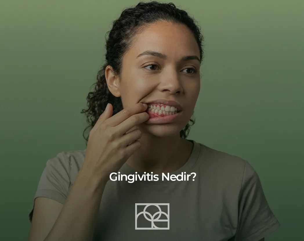 Gingivitis Nedir , diş eti hastalığı , Gingivitis , diş eti hastalığı Bilkent , Gingivitis , diş eti hastalığı Mustafa Kemal Mahallesi ,Gingivitis , diş eti hastalığı Çukurambar , Gingivitis , diş eti hastalığı Çayyolu Noedent Maidan Diş Kliniği