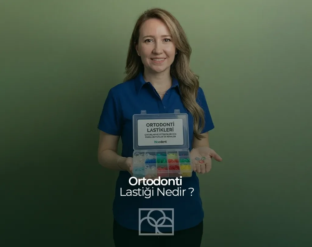 Ortodonti Lastiği , Ortodonti Lastiği Nedir , Mustafa Kemal Mahallesi , Noedent , Maidan Diş Kliniği