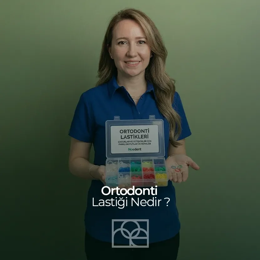 Ortodonti Lastiği , Ortodonti Lastiği Nedir , Mustafa Kemal Mahallesi , Noedent , Maidan Diş Kliniği