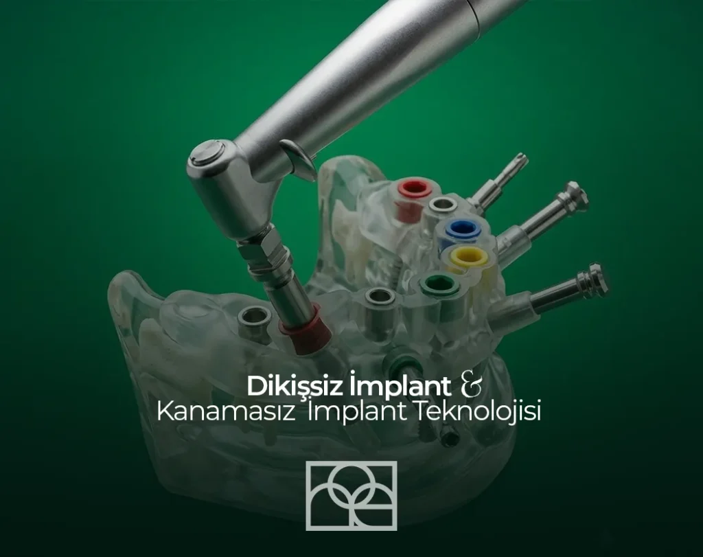 Dikişsiz İmplant, Kanamasız İmplant , Diş Çürükleri , Mustafa Kemal Mahallesi , Noedent , Maidan Diş Kliniği