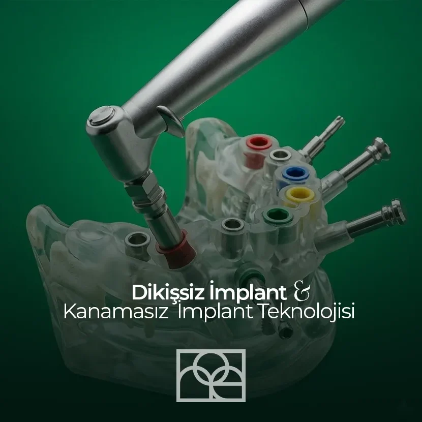 Dikişsiz İmplant, Kanamasız İmplant , Diş Çürükleri , Mustafa Kemal Mahallesi , Noedent , Maidan Diş Kliniği