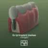 en iyi implant markası , en iyi implant markası ankara , en iyi implant markası bilkent, en iyi implant markası söğütözü , en iyi implant markası mustafa kemal mahallesi en iyi implant markası , en iyi implant markası ankara , en iyi implant markası bilkent, en iyi implant markası söğütözü , en iyi implant markası mustafa kemal mahallesi