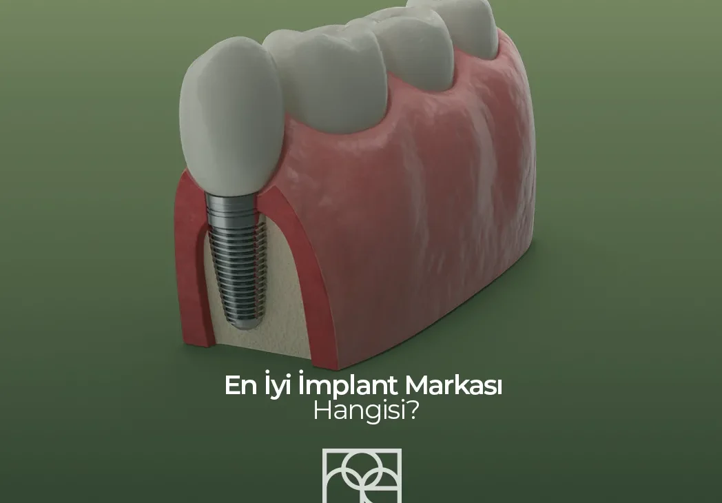 en iyi implant markası , en iyi implant markası ankara , en iyi implant markası bilkent, en iyi implant markası söğütözü , en iyi implant markası mustafa kemal mahallesi