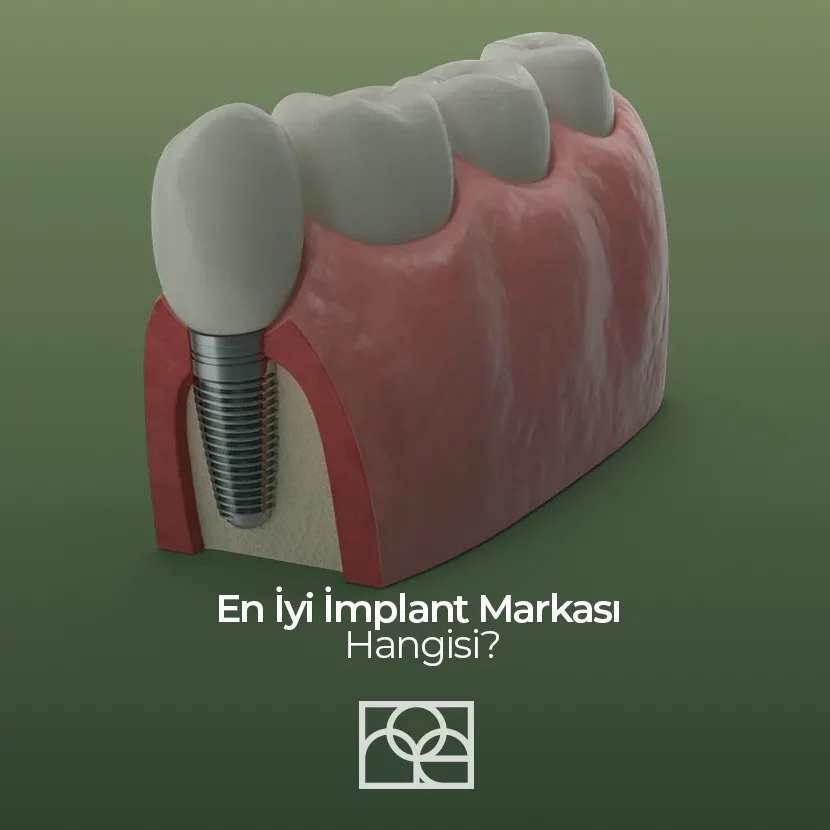 en iyi implant markası , en iyi implant markası ankara , en iyi implant markası bilkent, en iyi implant markası söğütözü , en iyi implant markası mustafa kemal mahallesi