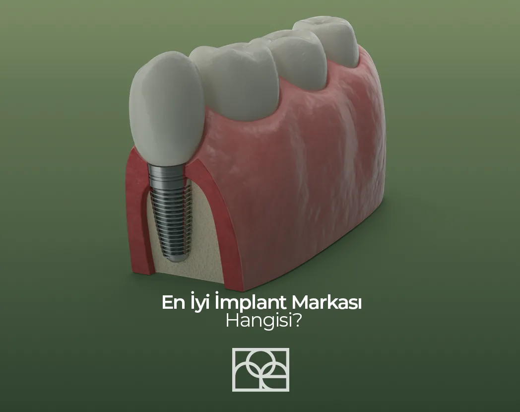 en iyi implant markası , en iyi implant markası ankara , en iyi implant markası bilkent, en iyi implant markası söğütözü , en iyi implant markası mustafa kemal mahallesi
