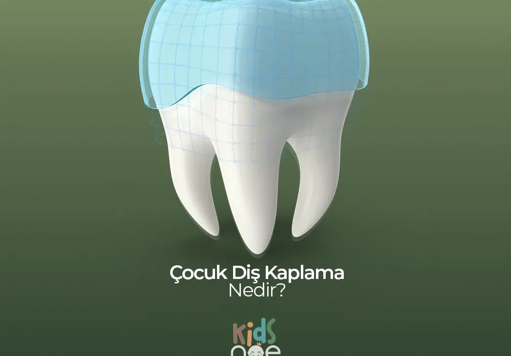 Çocuk Diş Kaplama Nedir? Ankara , Çocuk Diş Kaplama Nedir? Bilkent , Çocuk Diş Kaplama Nedir? Söğütözü, Çocuk Diş Kaplama Nedir? Mustafa Kemal Mahallesi , Çocuk Diş Kaplama Nedir? Çukurambar, Çocuk Diş Kaplama Nedir? Çayyolu - Özlem Nasibe Bayazıt, Ortodonti Uzmanı Mustafa Kemal Mahallesi, Ortodonti Uzmanı Bilkent , Ortodonti Uzmanı Söğütözü, Ortodonti Uzmanı Mahall Ankara , Çocuk Diş Hekimi Ela Öner Aytar Bilkent, Çocuk Diş Hekimi Ela Öner Aytar Çayyolu, Çocuk Diş Hekimi Ela Öner Aytar Mustafa Kemal, Çocuk Diş Hekimi Ela Öner Aytar Söğütözü,