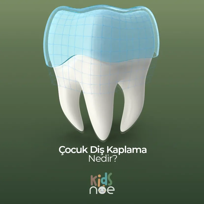 Çocuk Diş Kaplama Nedir? Ankara , Çocuk Diş Kaplama Nedir? Bilkent , Çocuk Diş Kaplama Nedir? Söğütözü, Çocuk Diş Kaplama Nedir? Mustafa Kemal Mahallesi , Çocuk Diş Kaplama Nedir? Çukurambar, Çocuk Diş Kaplama Nedir? Çayyolu - Özlem Nasibe Bayazıt, Ortodonti Uzmanı Mustafa Kemal Mahallesi, Ortodonti Uzmanı Bilkent , Ortodonti Uzmanı Söğütözü, Ortodonti Uzmanı Mahall Ankara , Çocuk Diş Hekimi Ela Öner Aytar Bilkent, Çocuk Diş Hekimi Ela Öner Aytar Çayyolu, Çocuk Diş Hekimi Ela Öner Aytar Mustafa Kemal, Çocuk Diş Hekimi Ela Öner Aytar Söğütözü,