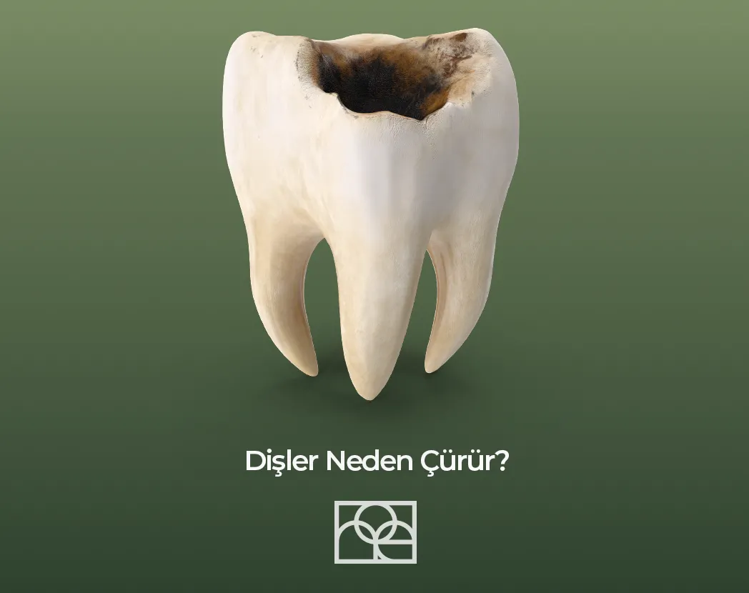 Dişler Neden Çürür? Ankara , Dişler Neden Çürür? Bilkent , Dişler Neden Çürür? Söğütözü, Dişler Neden Çürür? Mustafa Kemal Mahallesi , Dişler Neden Çürür? Çukurambar, Dişler Neden Çürür? Çayyolu - Özlem Nasibe Bayazıt, Ortodonti Uzmanı Mustafa Kemal Mahallesi, Ortodonti Uzmanı Bilkent , Ortodonti Uzmanı Söğütözü, Ortodonti Uzmanı Mahall Ankara , Çocuk Diş Hekimi Ela Öner Aytar Bilkent, Çocuk Diş Hekimi Ela Öner Aytar Çayyolu, Çocuk Diş Hekimi Ela Öner Aytar Mustafa Kemal, Çocuk Diş Hekimi Ela Öner Aytar Söğütözü,