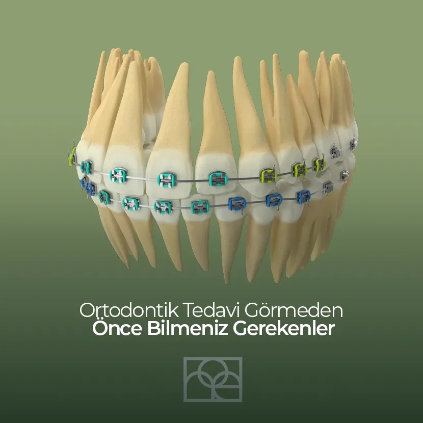Ortodontik Tedavi Görmeden Önce Bilmeniz Gerekenler