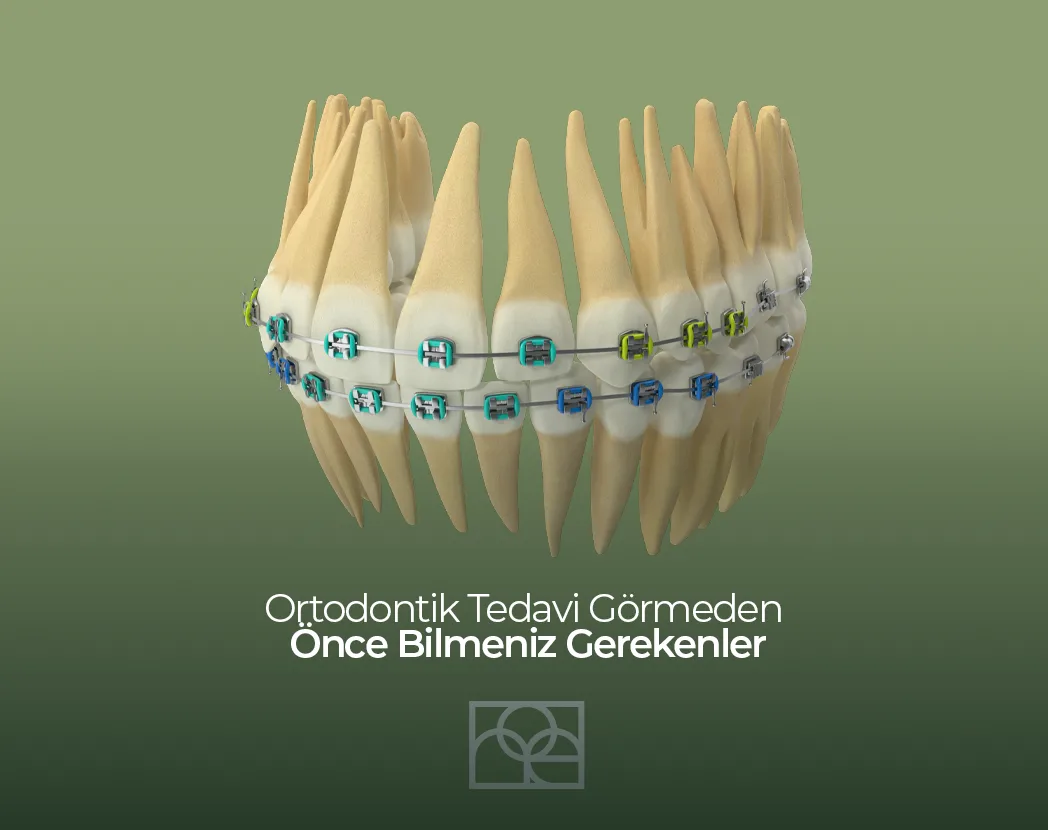 Ortodontik Tedavi Görmeden Önce Bilmeniz Gerekenler