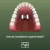 Damak Genişletme Aparatı