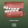 Dil İtimi Nedir ,Noedent Diş Kliniği , Maidan Diş Kliniği , Bilkent diş kliniği