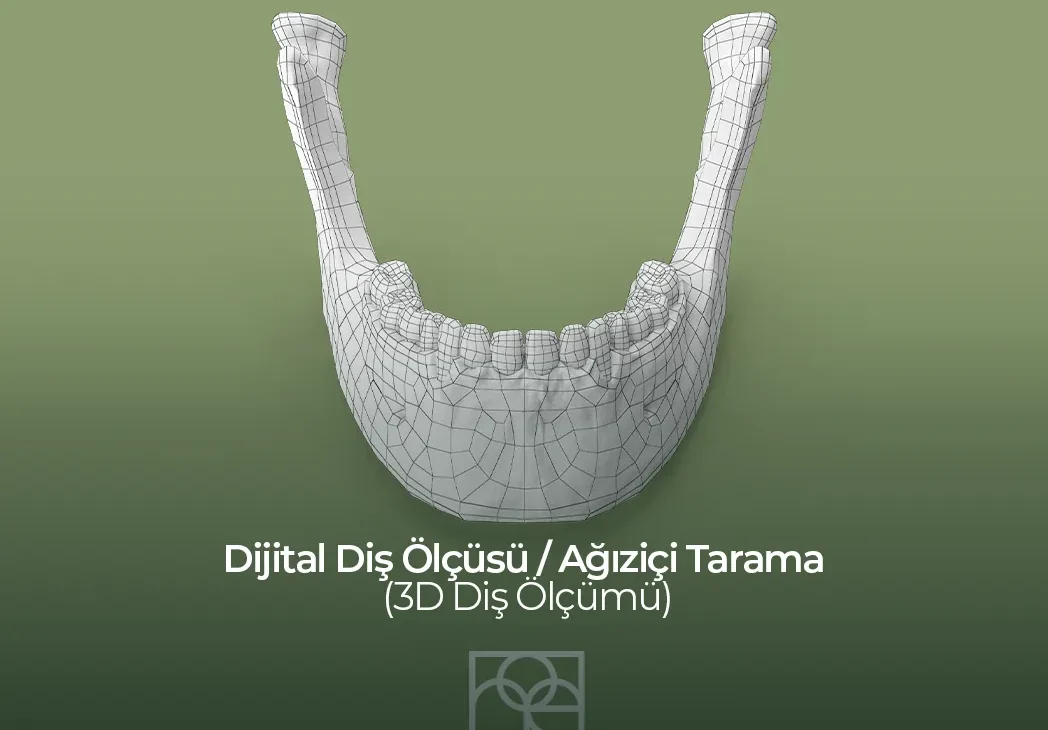 Dijital Diş Ölçüsü , Bilkent Mustafa Kemal Mahallesi , Noedent , Maidan Diş Kliniği