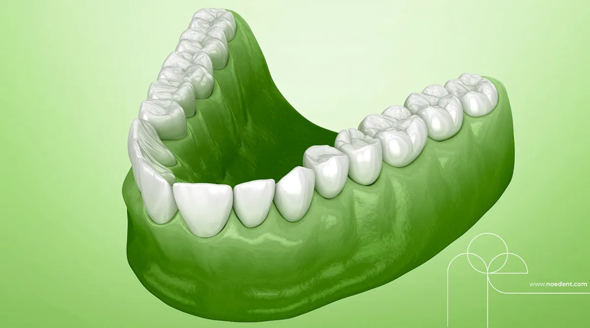 Damak Genişletme Aparatı , Damak Darlığı , çene ortopedisi , üst çene genişletme, Ankara Ortodonti , Bilkent Ortodonti , Ortodontist