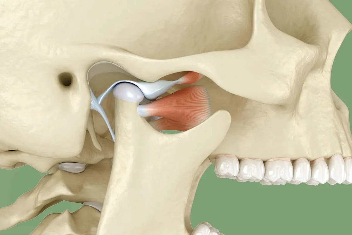 Çene Kilitlenmesi , Eklem İçi Disk Deplasmanı , Bruksizm, Diş Sıkma , Diş Gıcırdatma , Akut Kas Spazm , Noedent Diş Kliniği