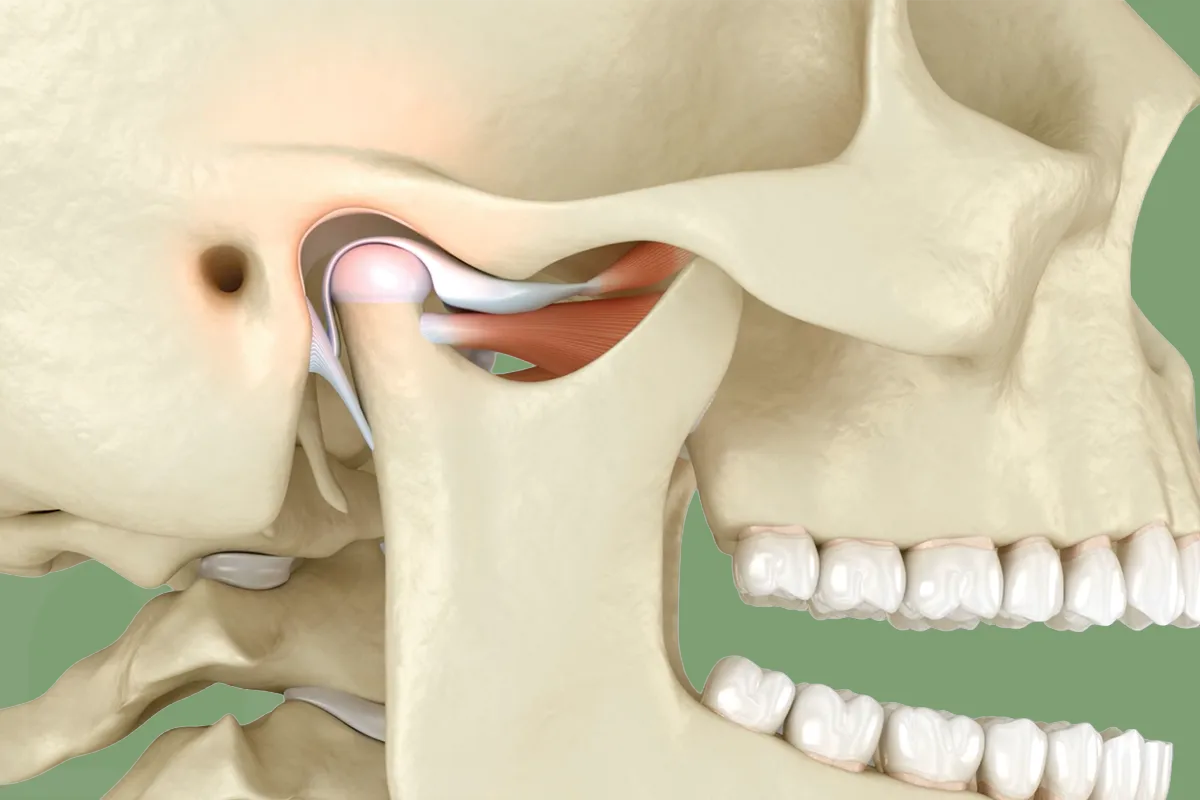 Çene Kilitlenmesi , Eklem İçi Disk Deplasmanı , Bruksizm, Diş Sıkma , Diş Gıcırdatma , Akut Kas Spazm , Noedent Diş Kliniği