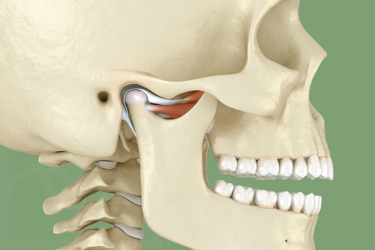 Çene Kilitlenmesi , Eklem İçi Disk Deplasmanı , Bruksizm, Diş Sıkma , Diş Gıcırdatma , Akut Kas Spazm , Noedent Diş Kliniği