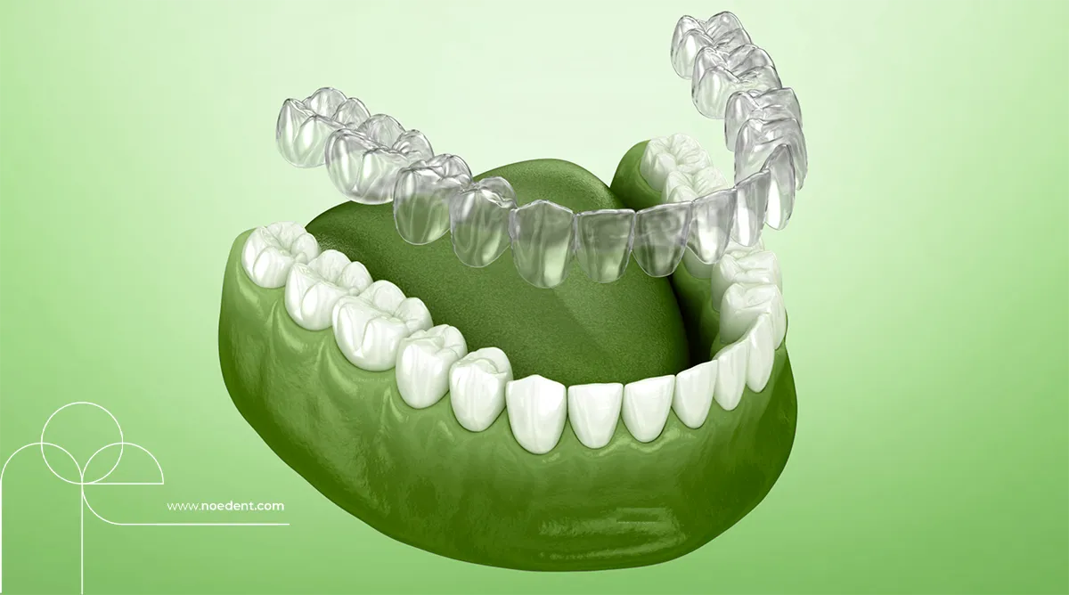 şeffaf plak tedavisi , invisalign bilkent , yetişkinlerde ortodontik tedavi, invisalign first , invisalign bilkent mustafa kemal , ortodonti bilkent , ortodontist çankaya , noedent diş kliniği , çocuklarda şeffaf plak , yetişkin ortodonti , ortodonti kliniği