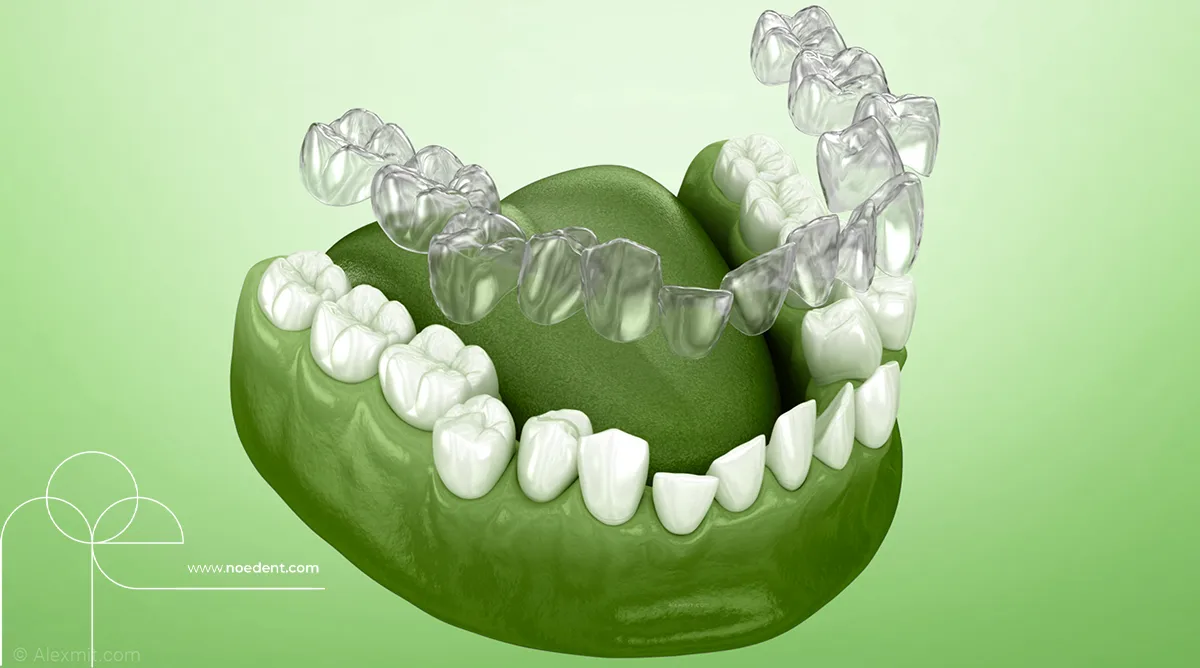 şeffaf plak tedavisi , invisalign bilkent , yetişkinlerde ortodontik tedavi, invisalign first , invisalign bilkent mustafa kemal , ortodonti bilkent , ortodontist çankaya , noedent diş kliniği , çocuklarda şeffaf plak , yetişkin ortodonti , ortodonti kliniği