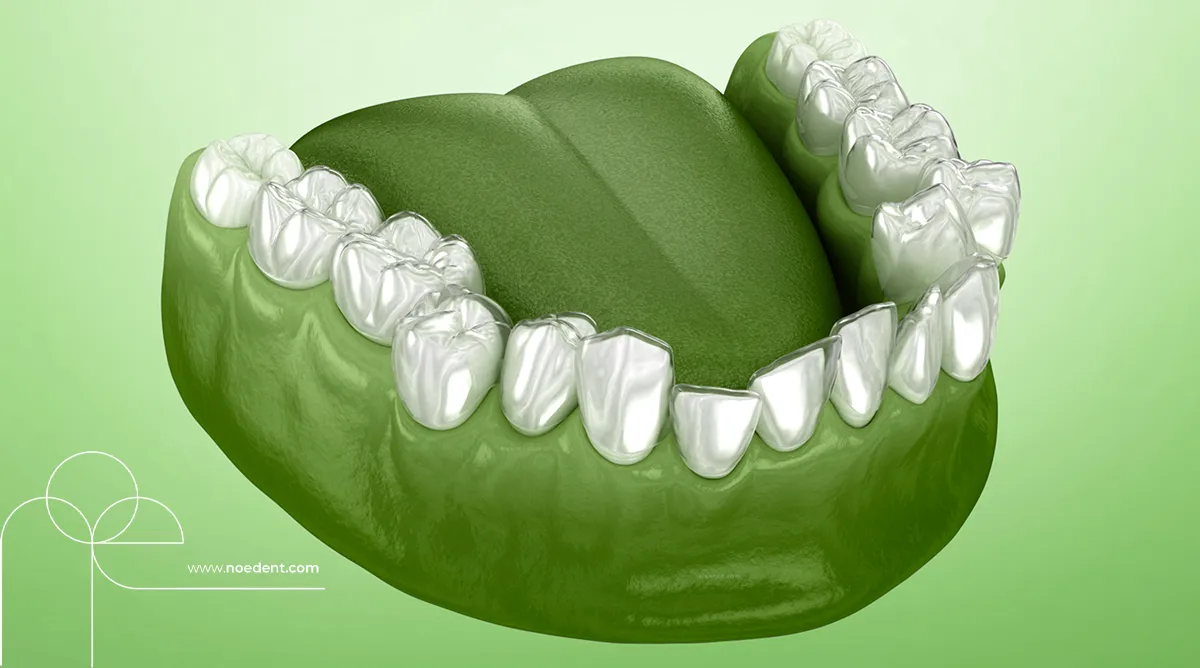 şeffaf plak tedavisi , invisalign bilkent , yetişkinlerde ortodontik tedavi, invisalign first , invisalign bilkent mustafa kemal , ortodonti bilkent , ortodontist çankaya , noedent diş kliniği , çocuklarda şeffaf plak , yetişkin ortodonti , ortodonti kliniği