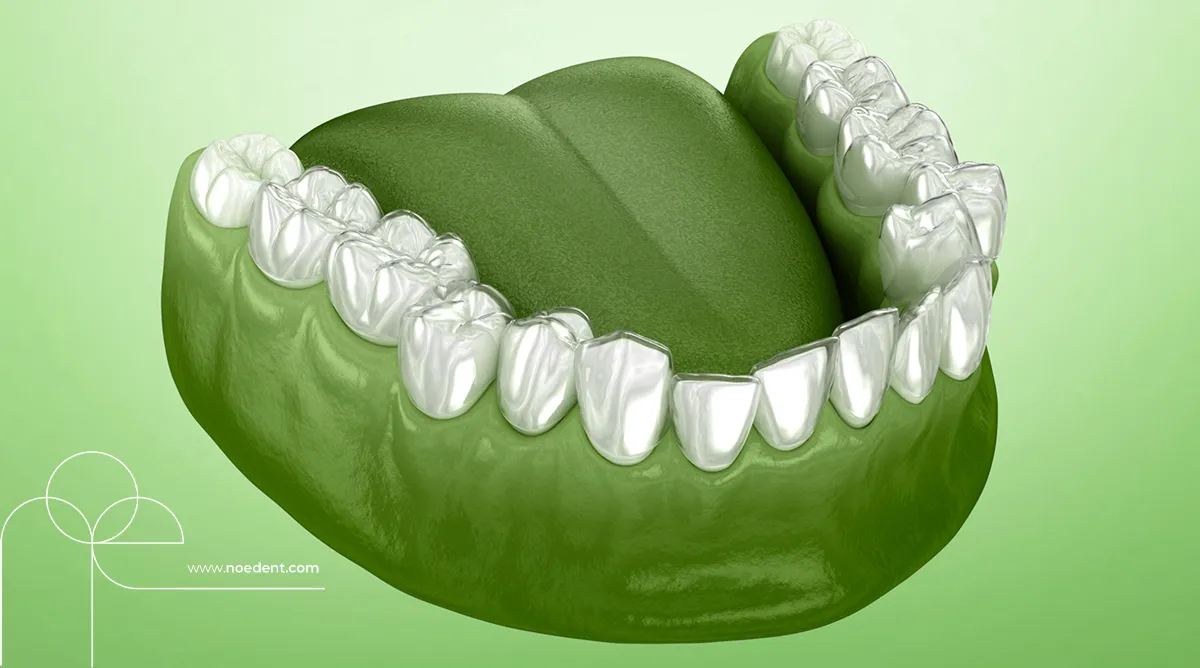 şeffaf plak tedavisi , invisalign bilkent , yetişkinlerde ortodontik tedavi, invisalign first , invisalign bilkent mustafa kemal , ortodonti bilkent , ortodontist çankaya , noedent diş kliniği , çocuklarda şeffaf plak , yetişkin ortodonti , ortodonti kliniği