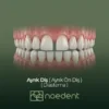 Ayrık Diş Tedavisi , Ayrık Ön Diş Tedavisi , Diastema tedavisi , ortodonti bilkent , ortodonti çankaya , ortodontist çankaya , çocuk diş hekimi bilkent, çocuk diş hekimi çankaya ,Noedent Diş Kliniği