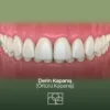 Derin Kapanış (Deep Bite) Nedir? Belirtileri ve Ortodontik Tedavi Aşamaları derin kapanış (deep bite) nedir belirtileri ve ortodontik tedavi aşamaları